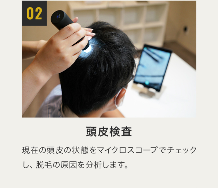 相談ステップ02 頭皮検査