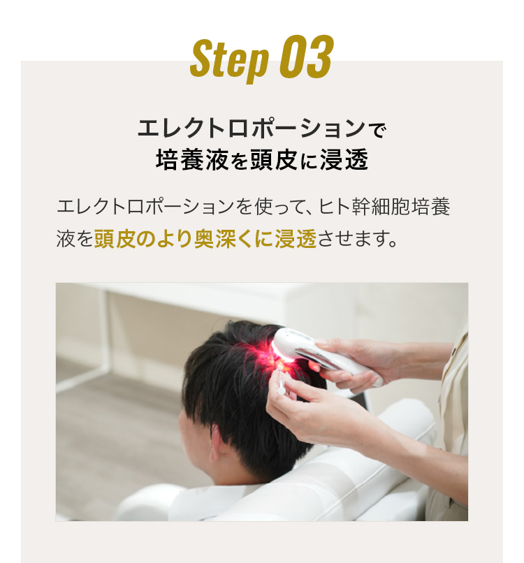施術の流れ03 エレクトロポレーションで培養液を頭皮に浸透