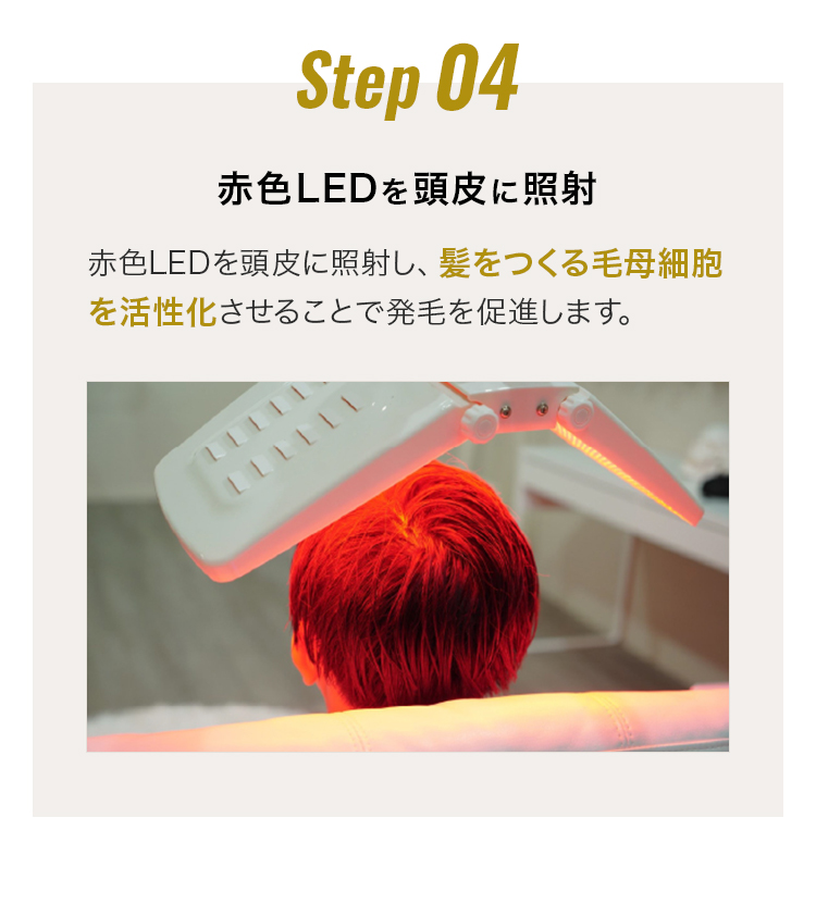 施術の流れ04 赤色LEDを頭皮に照射